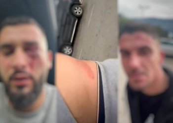 EMRAT+FOTOT/ Zbulohet identiteti i 3 shqiptarëve të dhunuar barbarisht nga serbët, zbardhet si ndodhi sulmi