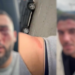EMRAT+FOTOT/ Zbulohet identiteti i 3 shqiptarëve të dhunuar barbarisht nga serbët, zbardhet si ndodhi sulmi