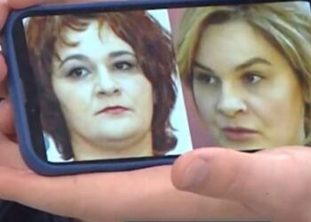 “Jam e bukur siç më ka bërë nëna”, mjekja numëron ndërhyrjet e Monika Kryemadhit