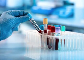 150 mijë individë me sëmundje të rralla në Shqipëri, 80% e diagnozave shfaqen në fëmijëri