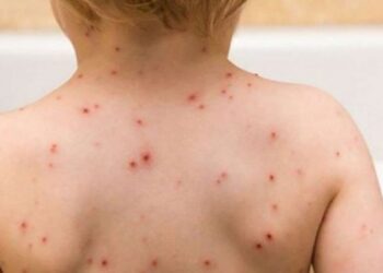 OBSH alarmon: Dyfishohen rastet e fruthit, Evropa rajoni më i prekur