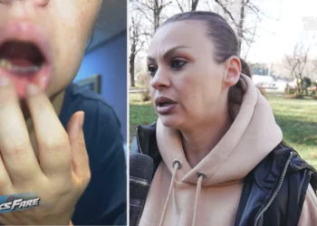 “Kam gabuar, por do të denoncoj”! Dentisti i prish dhëmbët, nofullën, harron frezën në rrënjë dhe kërcënon qytetaren në Korçë