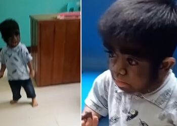 VIDEO/ “Kisha një dëshirë të tmerrshme për të ngrënë mace”, nëna fajëson veten për lindjen e djalit “ujk”