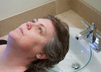 62-vjeçarja pa asnjë thinjë në kokë tregon recetën: Ma dha shoqja ime m’i hoqi njëherë e mirë