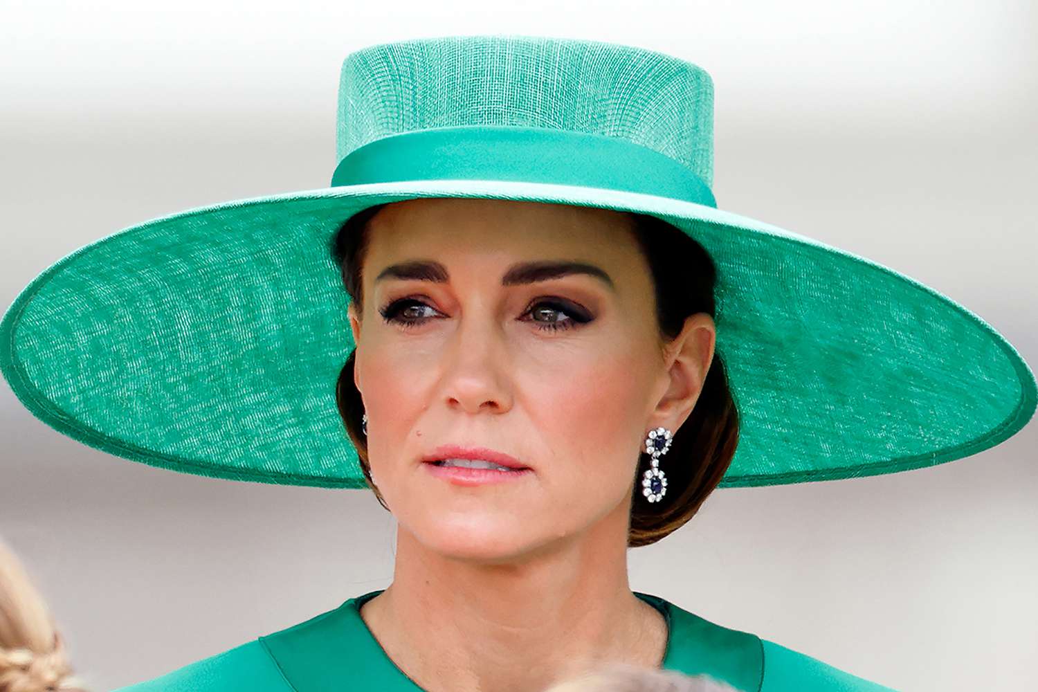 “Gati skelet, i kanë rënë flokët”, dalin detaje tronditëse nga beteja e Kate Middleton me kancerin