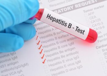 Hepatiti, vetëm 1 në 6 persona e dinë që e kanë, mjekët: Shpesh zbulohet kur mëlçia…