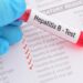 Hepatiti, vetëm 1 në 6 persona e dinë që e kanë, mjekët: Shpesh zbulohet kur mëlçia…