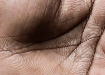 Nga luftimi i plakjes te forcimi i imunitetit, pse janë të rëndësishëm mikrobet në lëkurë