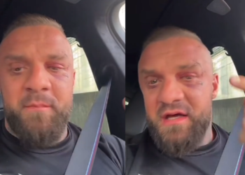 I nxirë dhe me plagë në fytyrë, Medi Iseni publikon për herë të parë video pas sherrit me Noizy-n