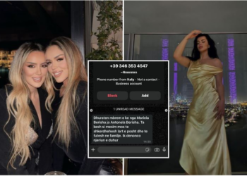 “Je … me burrin tim”/ E shpërfytyruan pas goditjeve në fytyrë, si u dhunua modelja në mes të Tiranës, Antonela Berisha dhe e motra e lanë në gjak