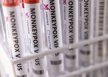 Lija e majmunit: A ekziston rreziku i një pandemie të re?