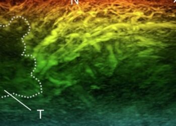 Një skaner i ri mund të ndryshojë rrënjësisht diagnozat e tri sëmundjeve