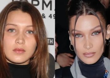 Operacionet plastike i ndryshuan jetën, si dukej Bella Hadidi përpara se të shpallej një nga vajzat më të bukura në botë