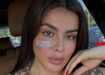 U sulmua nga dy motrat Berishaj, del ekspertiza për Klea Prengën: Dëmtimet e shkaktuar nga dhuna, të parikuperueshme