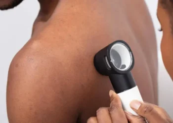 Shpiket pajisja që zbulon tumorin e lëkurës, ja si do të funksionojë