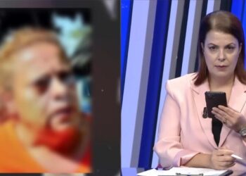 “Më leu me benzinë dhe më vuri flakën”, flet gruaja që u dogj nga burri, Melisa Trëndafili: Kishte marrë lekë borxh për…