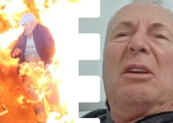 U përvëlua në protestën e Berishës, flet qytetari: Fajin e ka polici që e shtyu me këmbë molotovin!