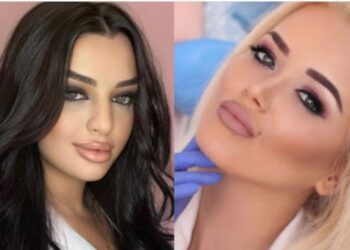 Kush janë admistratorët që kontrabandonin “BOTOX” për klinikat e tyre në Tiranë, disa prej tyre shumë të njohur