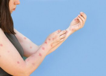 Shtohen rastet me zgjebe në vend, mjekët: Ja kush janë më të rrezikuarit