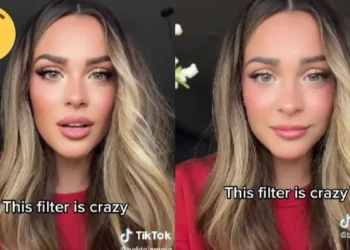 TikTok do të heqë filtrat e bukurisë për adoleshentët, shkaktojnë ankth sidomos tek vajzat