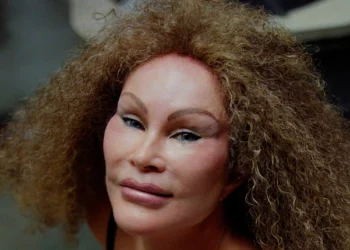 E fiksuar pas tigrave afrikanë/ Ndërron jetë “gruaja mace”, e njohur për ndërhyrjet ekstreme estetike