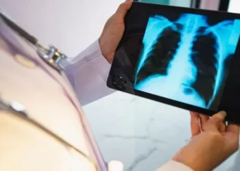 Çfarë është pneumonia bilaterale, sëmundja që ka prekur papa Françeskun?