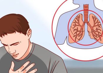 Rriten rastet me kancer të mushkërive tek ata që s’pinë duhan, studimi zbulon faktorin kryesor