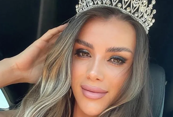 Tentoi ti ikte policisë pasi testi i alkoolit e nxori të dehur, vdes tragjikisht Miss Evropa-Kosova