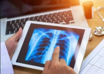 Zbulohet origjina e kancerit të mushkërive që prek kryesisht duhanpirësit