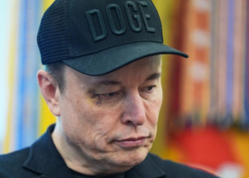 U shfaq me sy të nxirë në krah të Trump, Musk zbulon se kush e goditi me grusht
