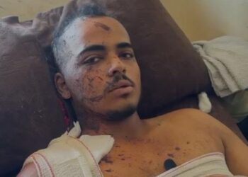I mbijetoi sulmit në spital, flet fotografi: Kur hapa sytë, të gjithë rreth meje kishin vdekur