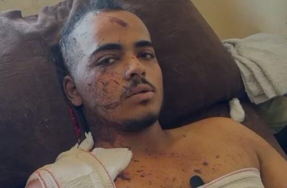 I mbijetoi sulmit në spital, flet fotografi: Kur hapa sytë, të gjithë rreth meje kishin vdekur