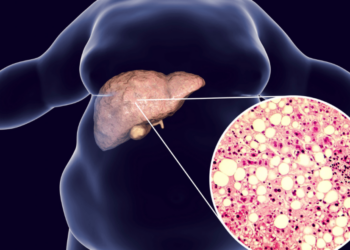 Studim me gjetje të rëndësishme për parandalimin dhe kontrollin e kancerit të mëlçisë