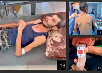 “Uria në çdo cep”, pamjet nga brenda spitaleve të Gazës që po tmerrojnë botën