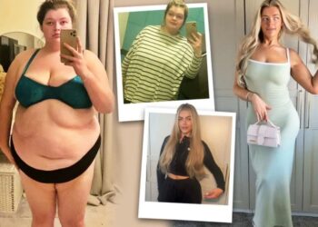 Nga 146 kg në yll si Margot Robbie! Transformimi i pabesueshëm i 26-vjeçares