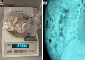 Nga tregtare veshjesh në trafikante! Çfarë i gjetën në stomak 46-vjeçares në aeroportin e Italisë