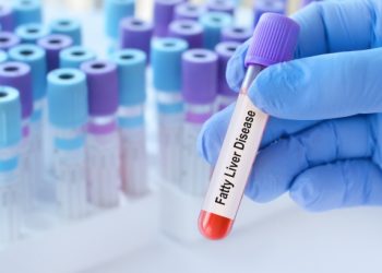 Sëmundja e heshtur që dëmton edhe zemrën: Shkaqet, simptomat dhe si të parandalohet