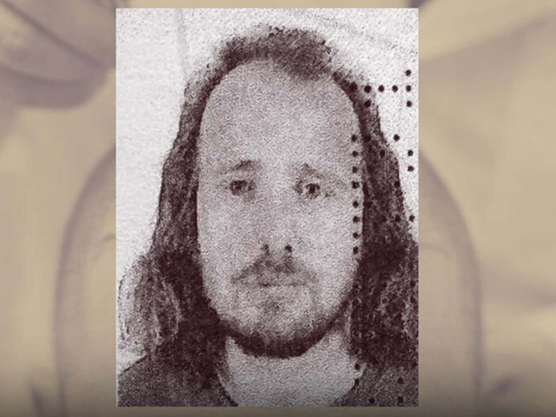 EMRI   Shkoi që të mbillte flokët në Turqi  vdes pas transplantit shqiptari