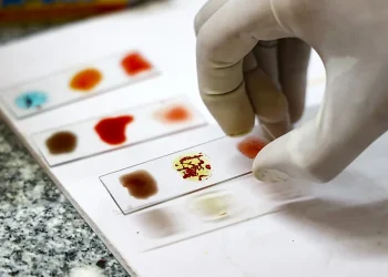 Magjia e grupit më të rrallë të gjakut në botë, eksperimenti që mund të shpëtojë jetë