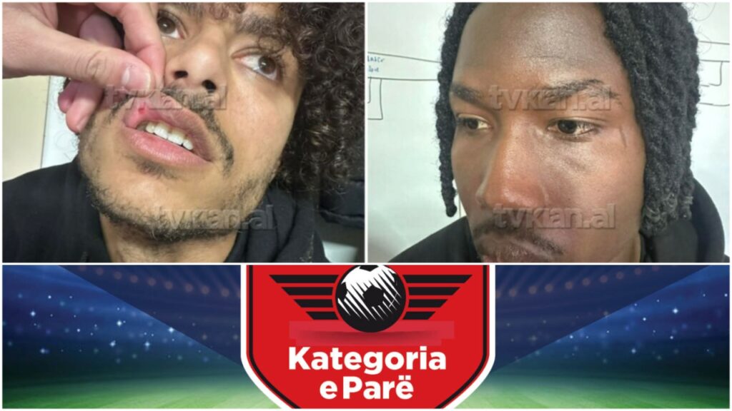 Dhuna ndaj Skënderbeut  Disiplina dënon Ilirinë  Zbulohen vendimet