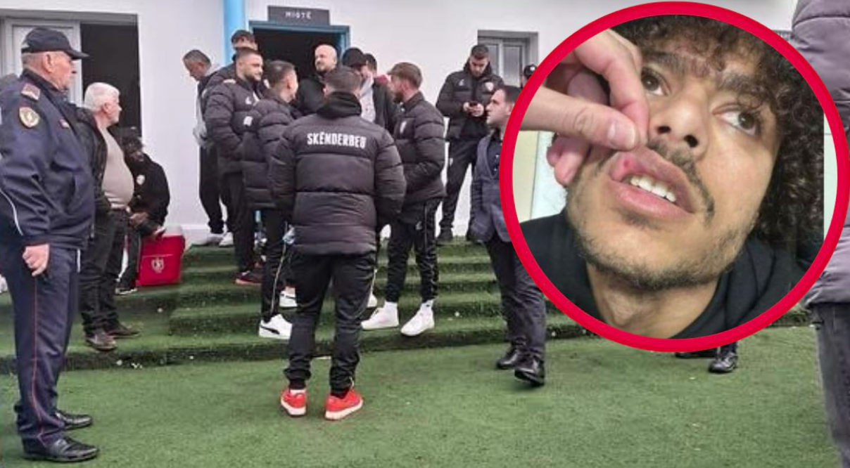 Dhunuan kundërshtarët para ndeshjes në Fushë Krujë  nën hetim tre futbollistët e skuadrës  Iliria 