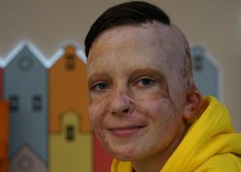 VIDEO- Rrëfimi prekës i 11-vjeçarit ukrainas përlot sallën në Parlamentin Europian/ Raketat ruse i vranë nënën në spital!