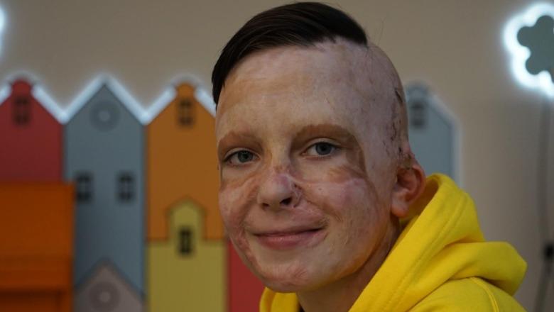 video-rrefimi-prekes-i-11-vjecarit-ukrainas-perlot-sallen-ne-parlamentin-europian-raketat-ruse-i-vrane-nenen-ne-spital