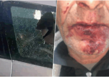 U dhunuan brenda makinës, gruaja tregon si ndodhi ngjarja: Jemi ngujuar në shtëpi nga frika