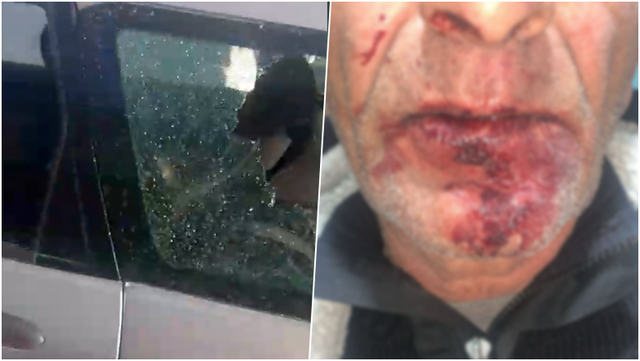 U dhunuan brenda makinës  gruaja tregon si ndodhi ngjarja  Jemi ngujuar në shtëpi nga frika