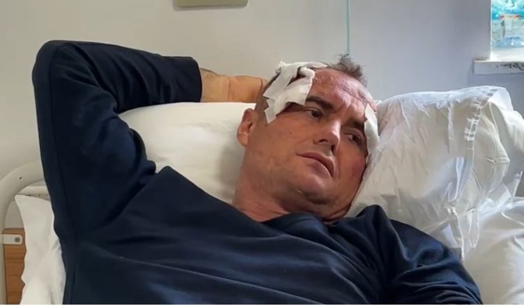 I riu dhunohet nga polici në Fier  I komentova motrës së tij në Facebook je bërë shumë e bukur