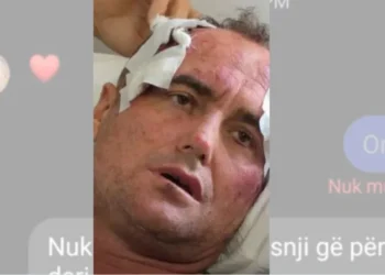 “Je më e bukura e fshatit”, reagon motra e 46-vjeçarit të dhunuar pas publikimit të mesazheve: Mjaft me këtë telenovelë, s’kërkojmë hakmarrje por..