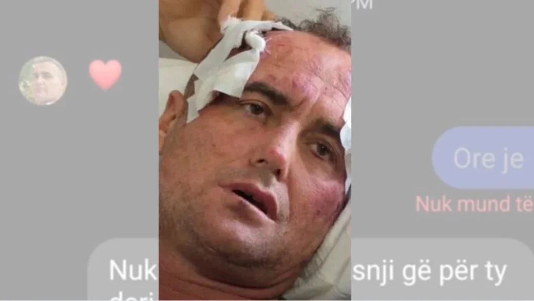  Je më e bukura e fshatit   reagon motra e 46 vjeçarit të dhunuar pas publikimit të mesazheve  Mjaft me këtë telenovelë  s kërkojmë hakmarrje por  