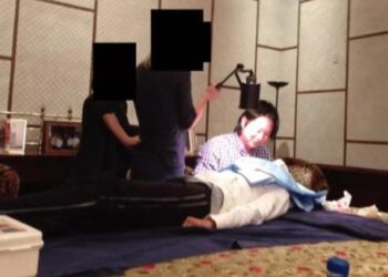 Pamje të rënda nga dosja “Epstein”/ Del fotoja e një kirurgu që operon një vajzë mbi tavolinën e ngrënies!