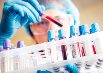 47-vjeçarja shqiptare në Itali humb jetën pas diagnozës së gabuar, familja dëmshpërblehet me 300 mijë euro